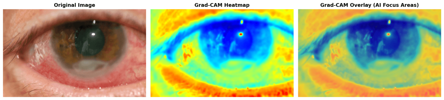 Grad-CAM Analysis